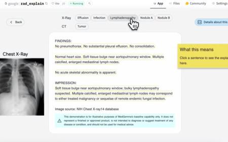 谷歌重磅发布三大Gemma模型变体，AI医疗、手语翻译与海豚语言解锁新可能！