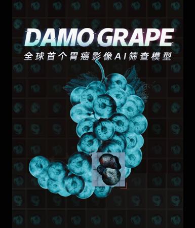阿里达摩院联合发布全球首个胃癌影像筛查 AI 模型 DAMO GRAPE
